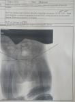 Рентген тазобедренных суставов фото 1