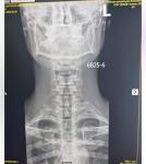 Лечение остеохондроза, дефспондилёза, унковертебрального артроза фото 1