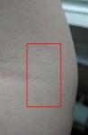 Появились мелкие красные точки на коже, похожие на укол иголкой фото 2