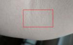 Появились мелкие красные точки на коже, похожие на укол иголкой фото 1