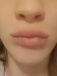 Ассиметрия губ во время разгоора фото 3