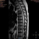 Снимки МРТ онлайн у невропатолога фото 1