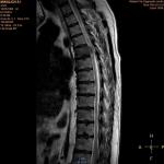 Снимки МРТ онлайн у невропатолога фото 2