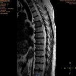 Снимки МРТ онлайн у невропатолога фото 3
