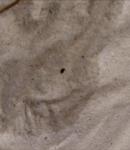 Черные бобовидные зёрнышки в кале у ребенка фото 2