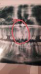 Панорамный снимок зубов фото 1