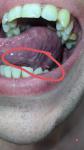 Десна и язык воспаление фото 1
