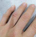 Воспаление сустава на пальце руки фото 2