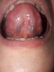 Болит горло почти месяц фото 4