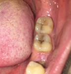 Боль зубов отдает в затылок фото 1