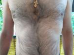 Увеличение под левой грудью у мужчины фото 1