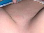 Розовая сыпь на груди и животе, без зуда и боли фото 3