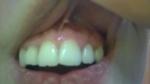Пошатывание зубов фото 1