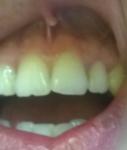 Пошатывание зубов фото 2