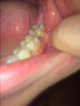 Боль в десне около зуба фото 1