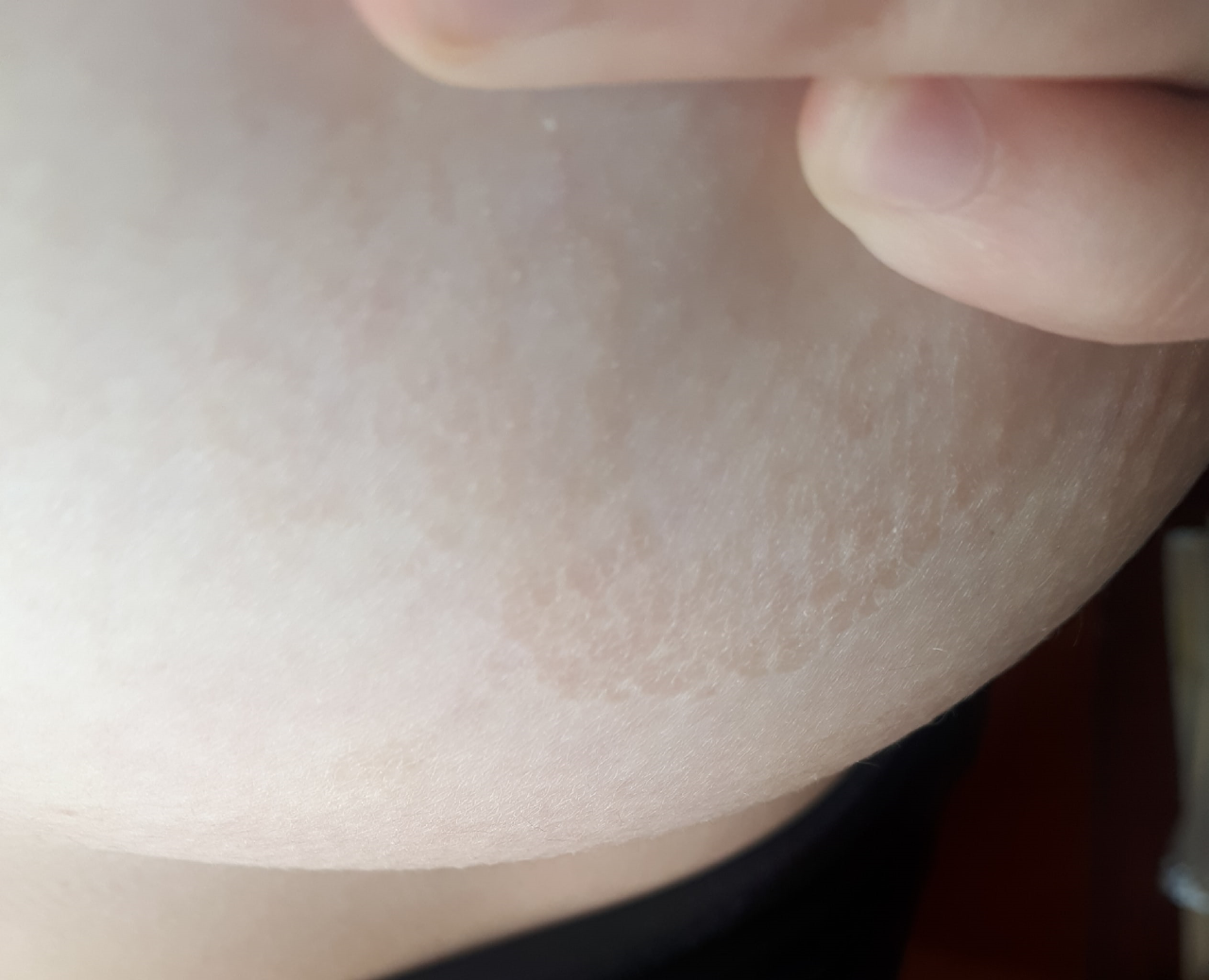 коричневые пятна на груди беременность фото 19