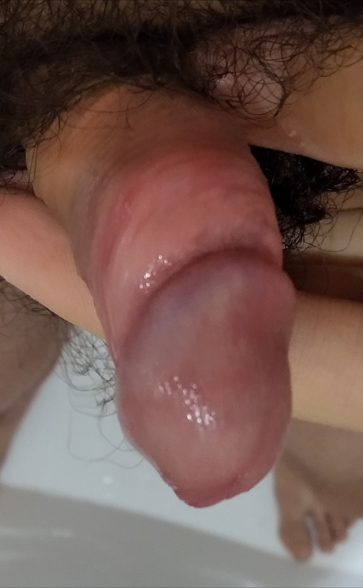 вагинит при мастурбации фото 63