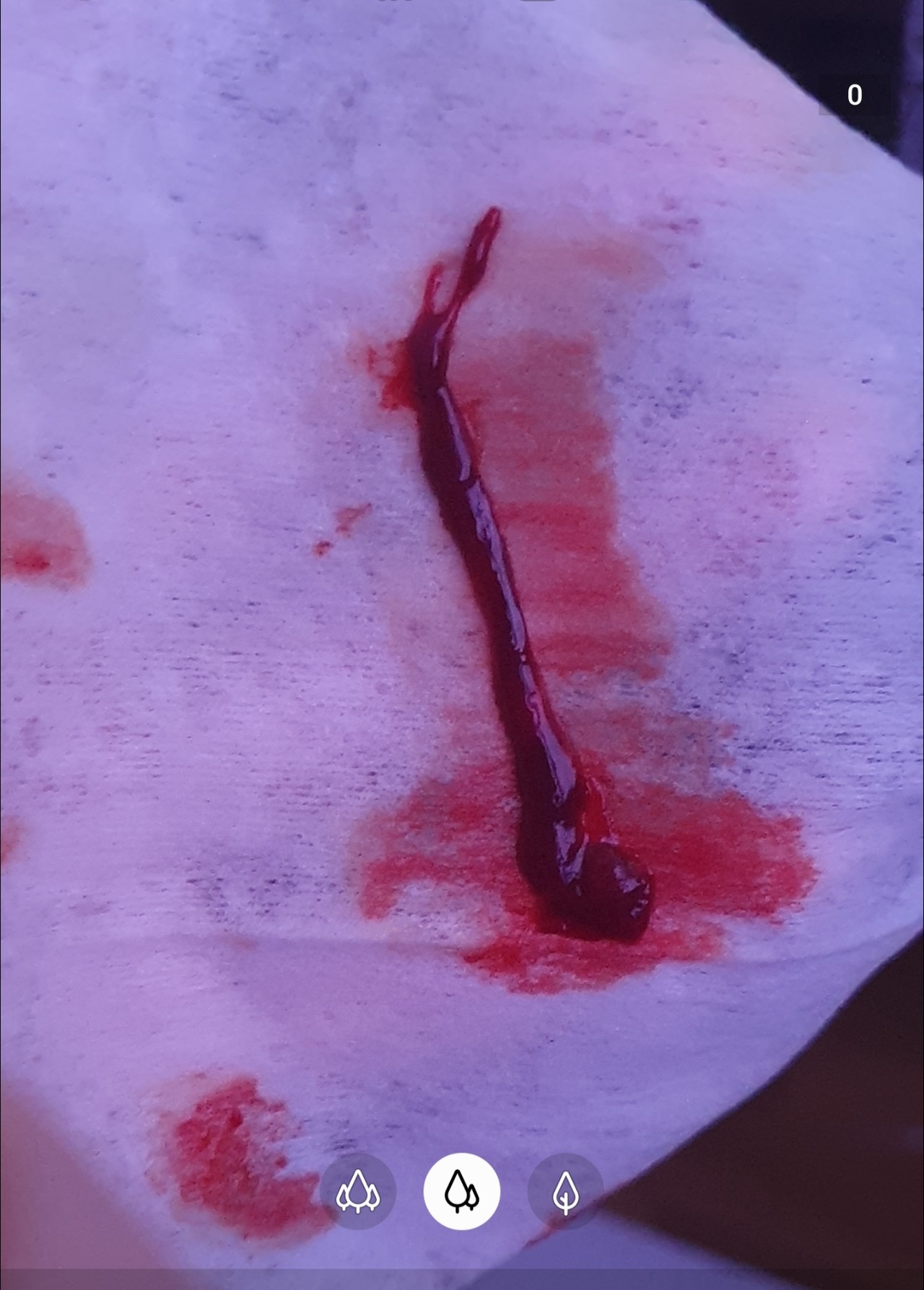 кровяные сгустки в сперме у мужчин фото 69
